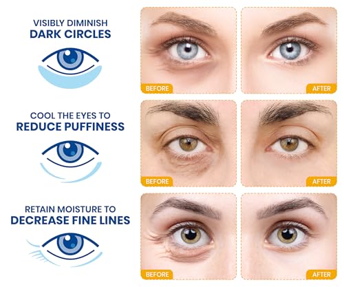 24k Gold Eye Masks for Dark Circles and Puffiness (30 Pairs) - With Hyaluronic Acid, Perfect for Women, Valentines Day Gifts