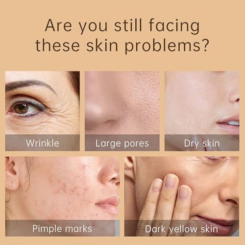 Snail Moisturizer for Women: Repair and Hydrate Dry Skin with Snail Secretion Filtrate